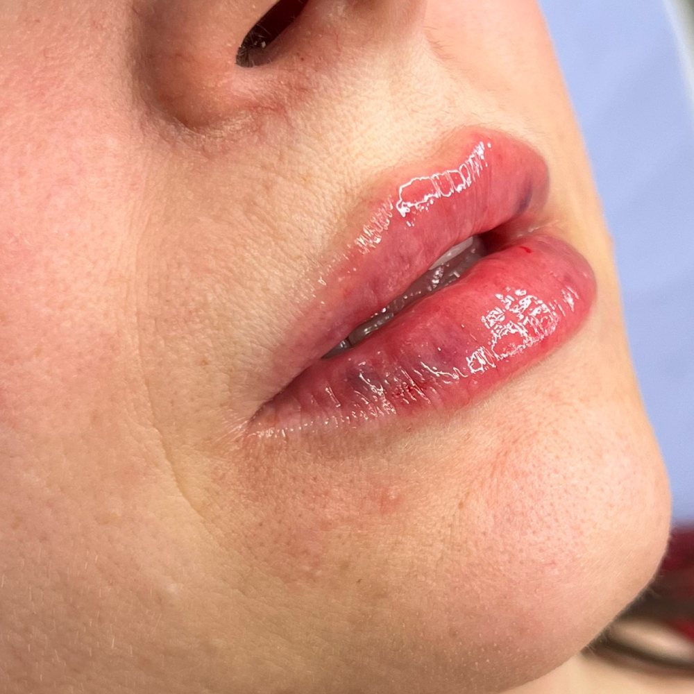 After treatment