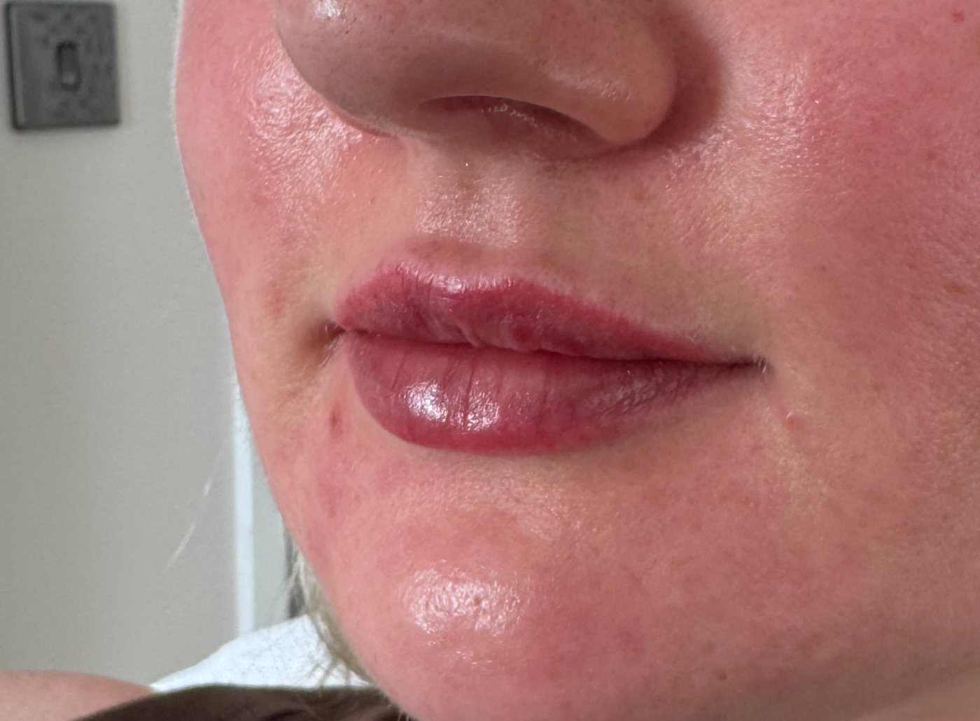 After treatment