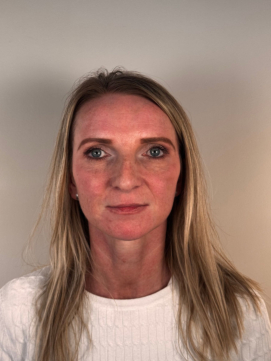 Same patient after treatment