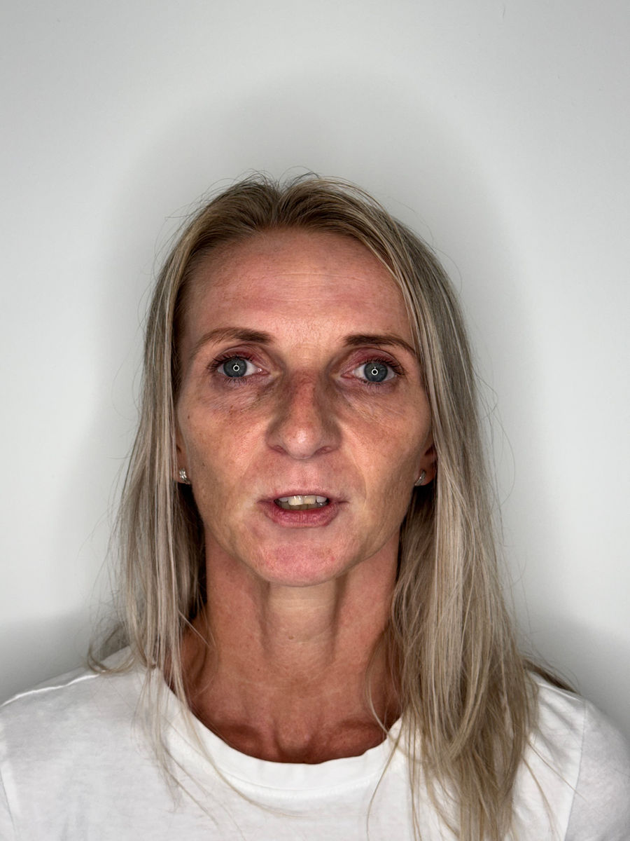 Patient before treatment