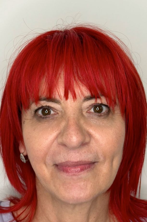 Before-and-after result