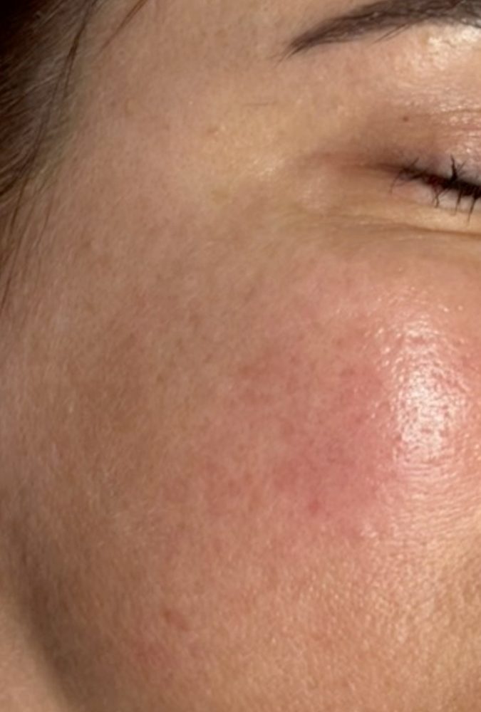 Before-and-after result